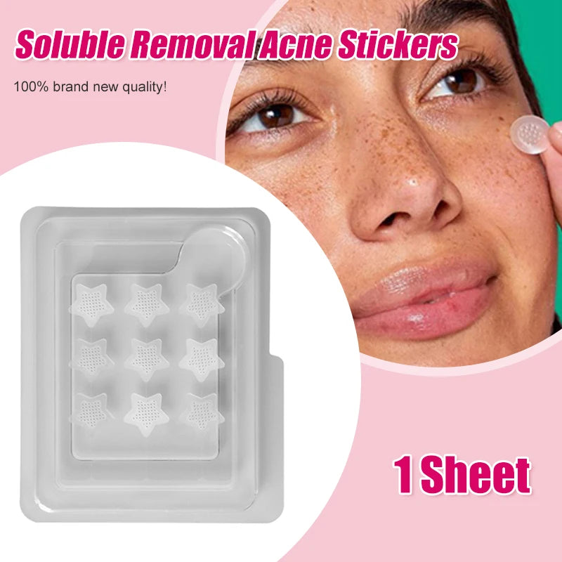 Salicylic AcidRemoval Acne Stickers Microneedle Blemish Treatment Facial Healing Treatment Skin Care Patch Tools Water-Soluble