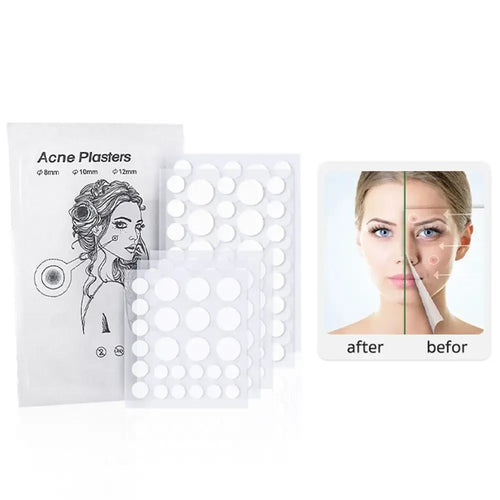 Acne pimple patch stickers, white circular adhesive dots in a sealed packet