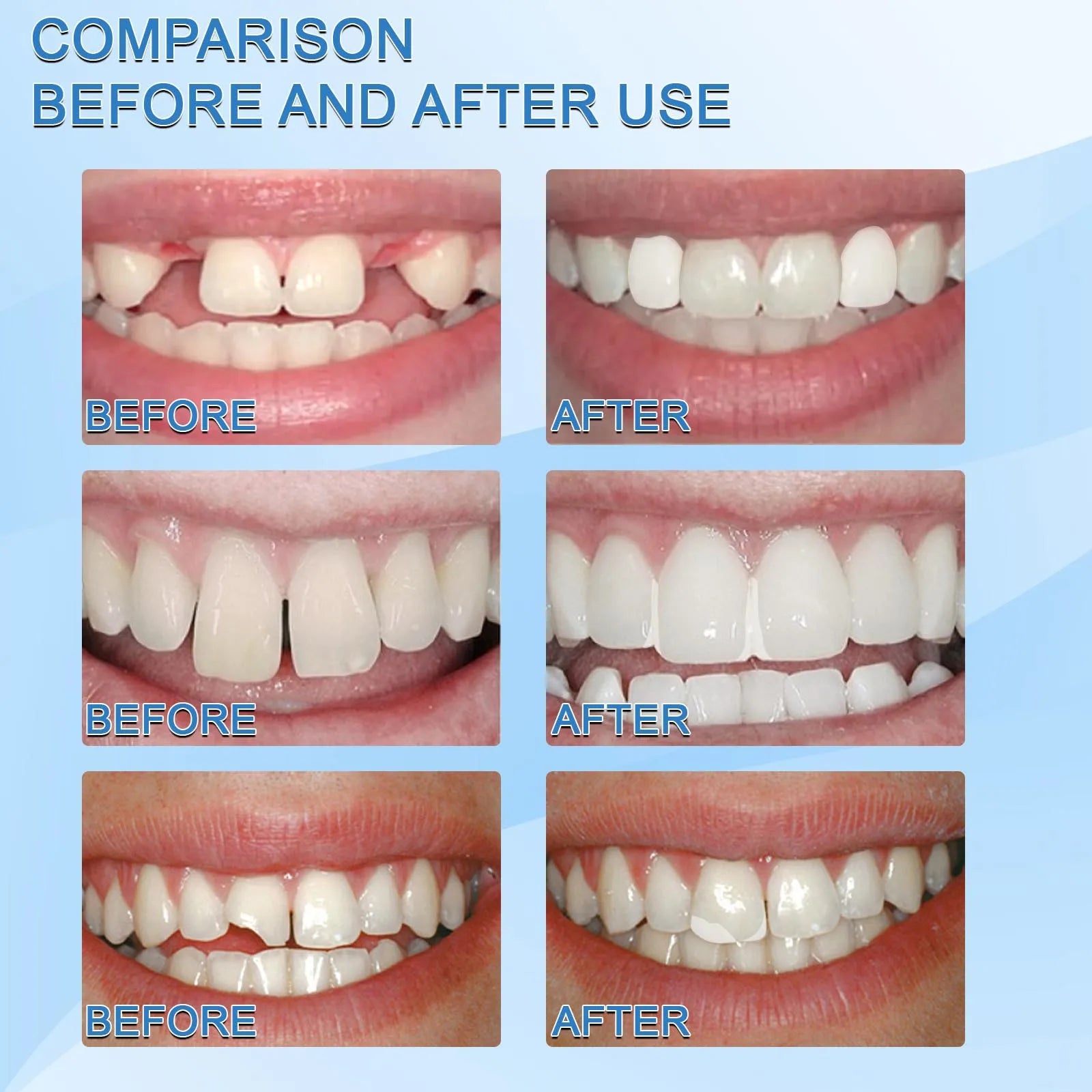 Temporary Tooth Repair Beads | Food Grade Dental Filling Material for Missing Broken Teeth, Denture Adhesive Solid Glue