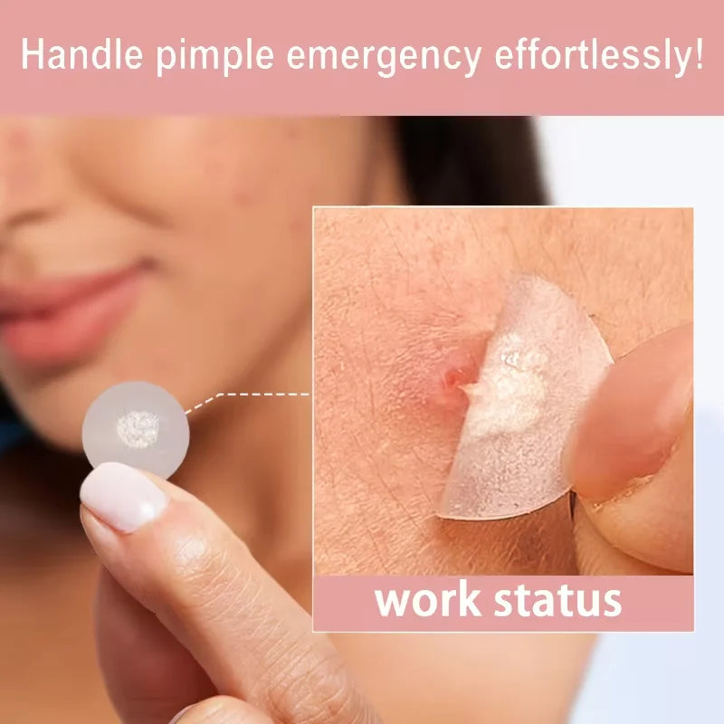 24PCSHydrocolloid acne patches,hydrocolloid invisible patch, mild formula,,which will help with better acne removal