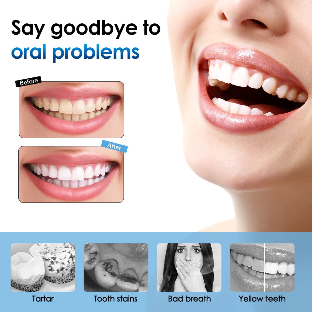 Electric ToothBrush Sonic Dental Scaler Cleaner Teeth Plaque Calculus Tobacco Stains Tartar Remover Teeth Whitening Cleaning