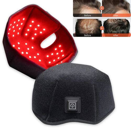 Red light therapy LED helmet device for hair growth and scalp wellness. Includes before and after results.