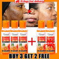 Yellow Peeling Oil for Dark Skin - 100ml Professional Exfoliating Treatment Scrubs Treatments 100ml-5PCS Tidesmit