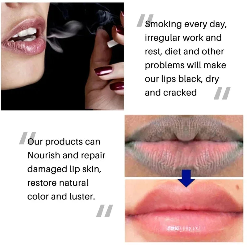 Lip Exfoliating Scrub for Dark Lips – Moisturizing Repair Balm Lip Care Tidesmit