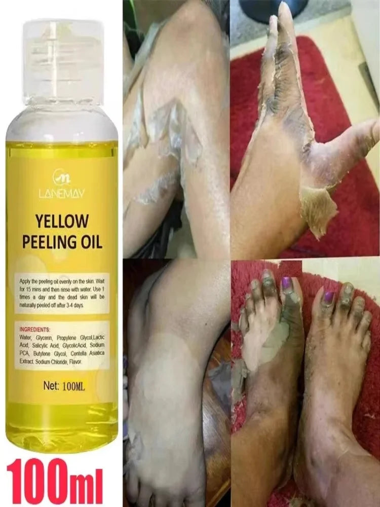 Yellow Peeling Oil for Body Exfoliation - Professional Brightening Serum Scrubs Treatments Tidesmit