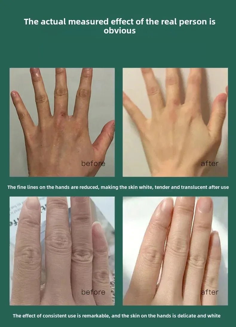 Hand cream for removing wrinkles on finger joints, removing hand wrinkles, and reducing joint roughness and blackness