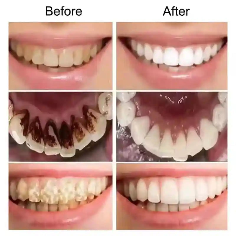 Tidesmit 7.5% Hydroxyapatite Probiotic Whitening Toothpaste for enamel repair and fresh breath.