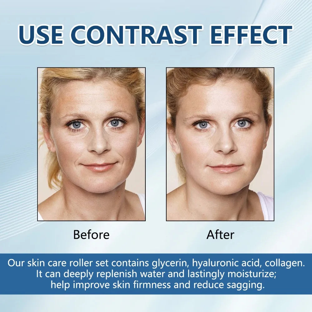 Skincare Roller Essence Set Tightens Lifts Skin Moisturizes Whitens Brightens Deeply Hydrates Long Lasting For All Skin Types