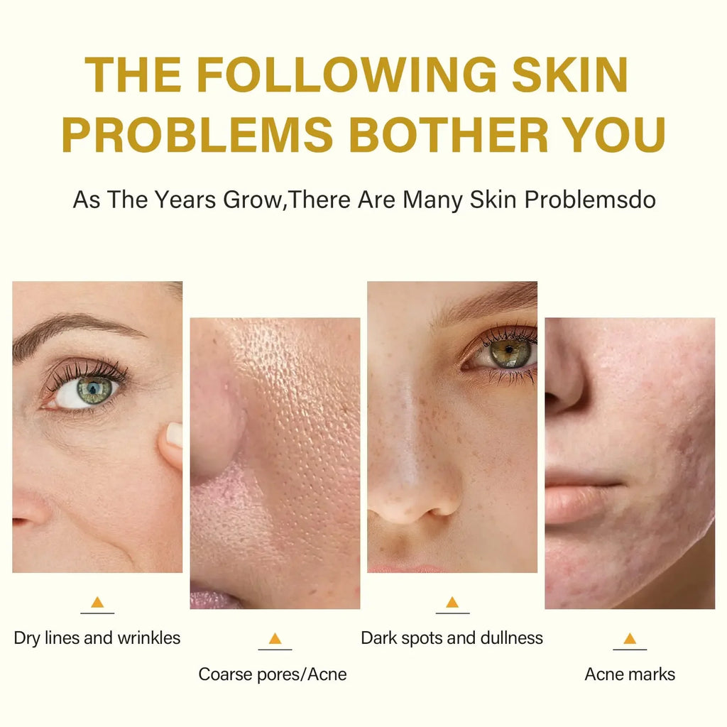 Acid Peeling Serum Chemical Exfoliant Peel for remove Face Dark Skin Spots Whiten Lighten Melanin Peeling Solution Skin Peel