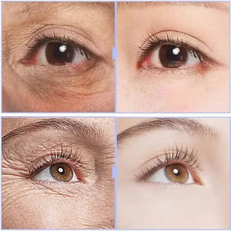 Anti Aging Eye Cream for Dark Circles & Puffiness - Tidesmit EU Scrubs Treatments Tidesmit