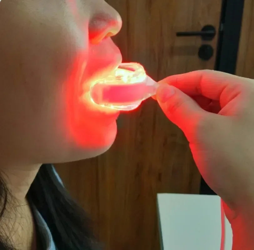 Gum Disease Red Light Therapy Device - HLKGO-USBO3 Oral Wellness Relaxation Treatment Tidesmit