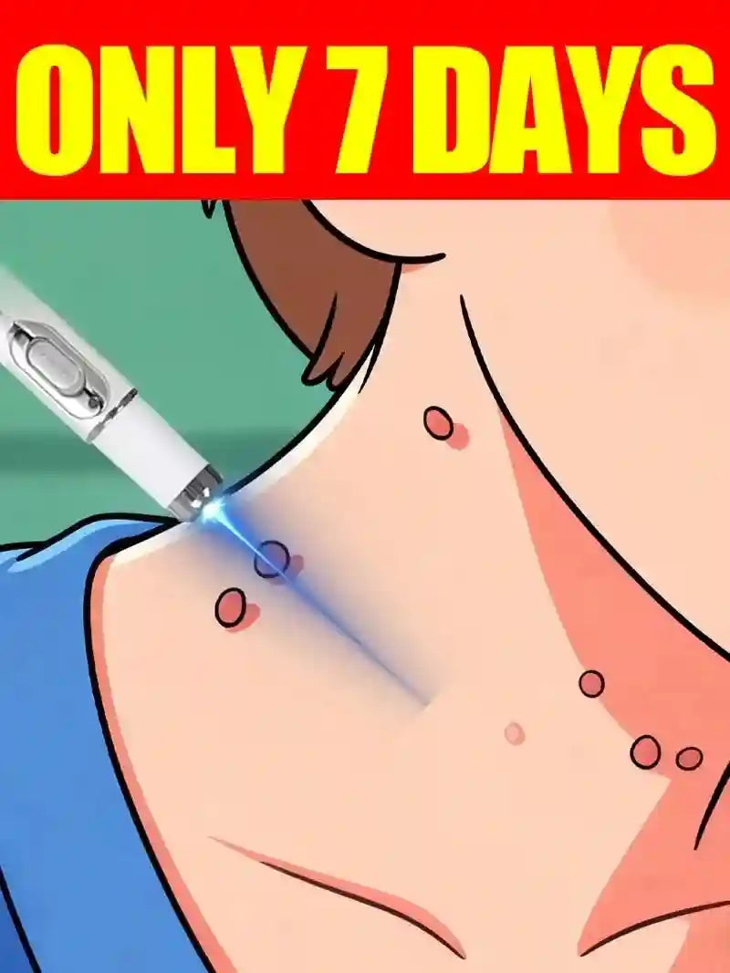 Wart Removal Roller Tool - Painless Skin Care Set by Tidesmit Massage Roller Tidesmit
