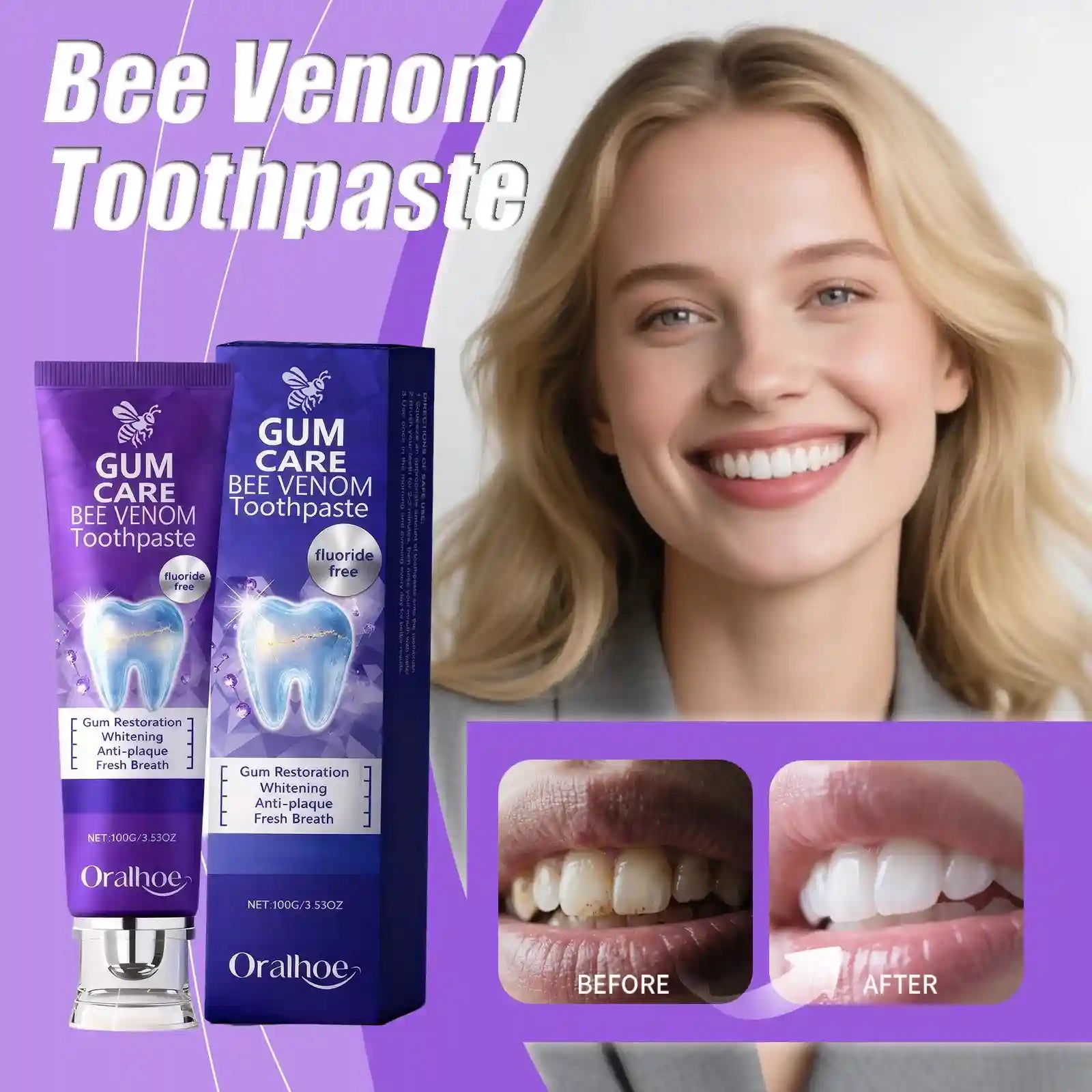 Tidesmit Bee Venom teeth whitening toothpaste for deep cleaning, stain removal, and fresh mint breath.