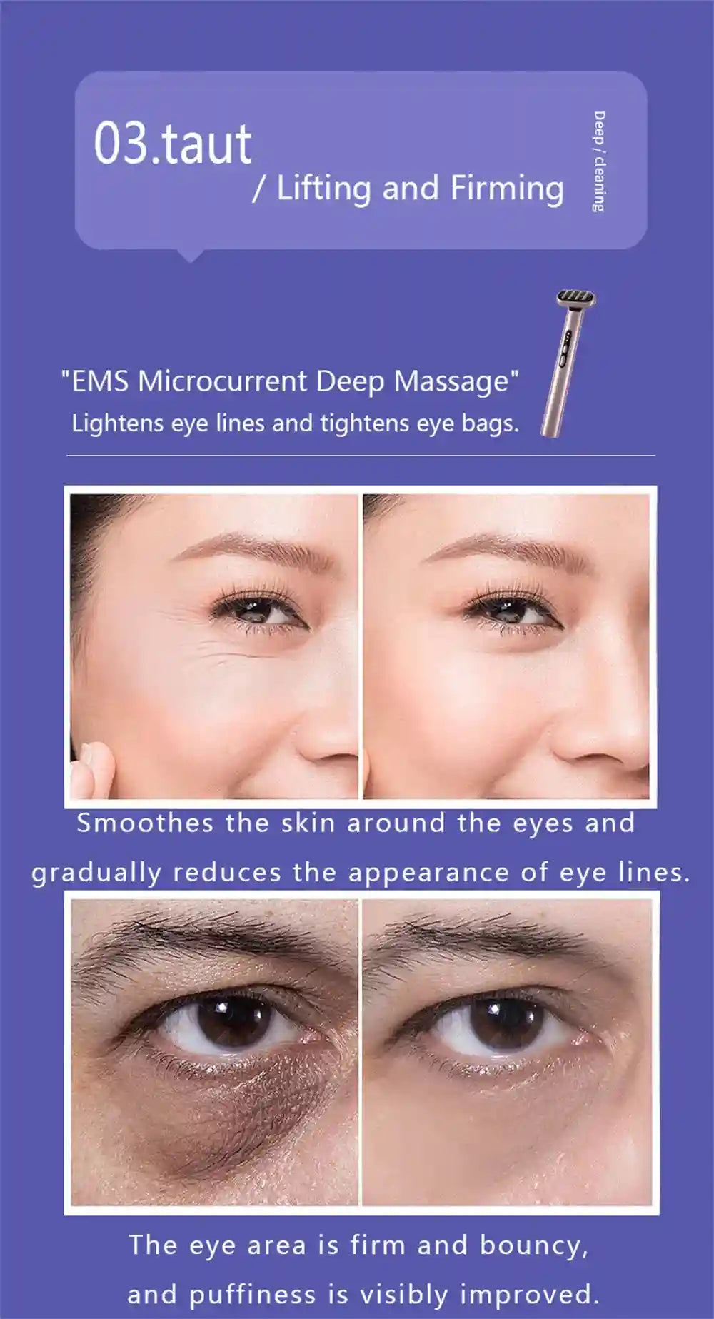 Tidesmit Microcurrent LED Face Massager Wand - Portable Skin Tool Massage Roller Tidesmit