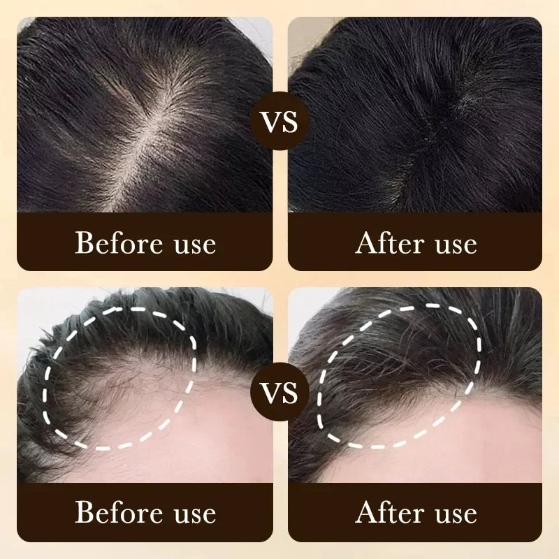 Biotin Hair Growth Oil | Salon-Quality Scalp Treatment - Tidesmit Scrubs Treatments Tidesmit