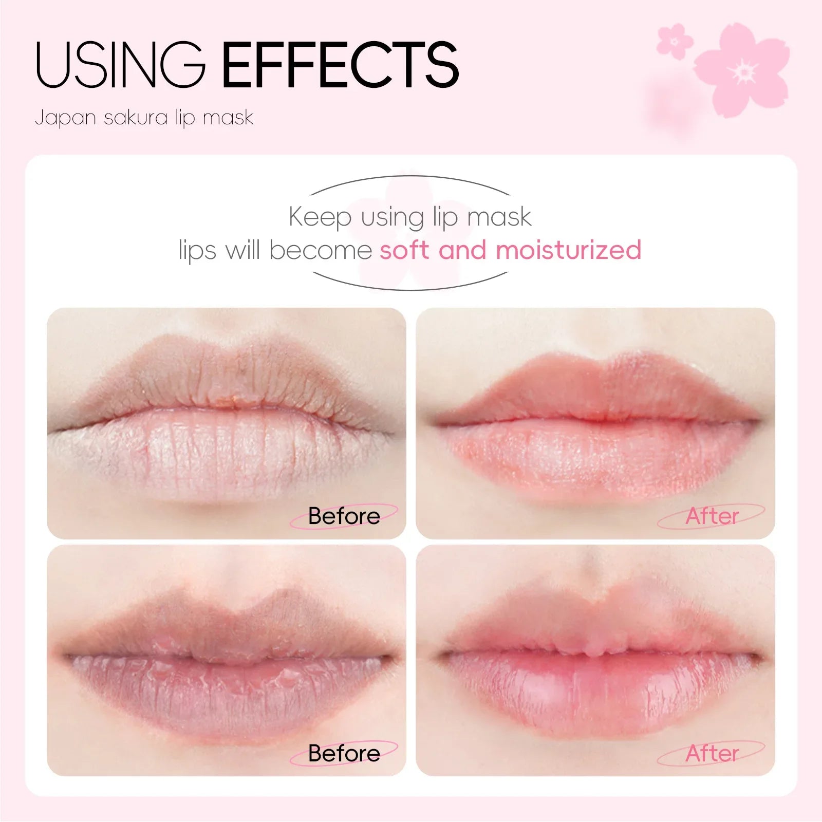Hydrating Lip Mask Patches - Nourishing Gel Lip Care Treatment (10 Pack) Lip Care Tidesmit