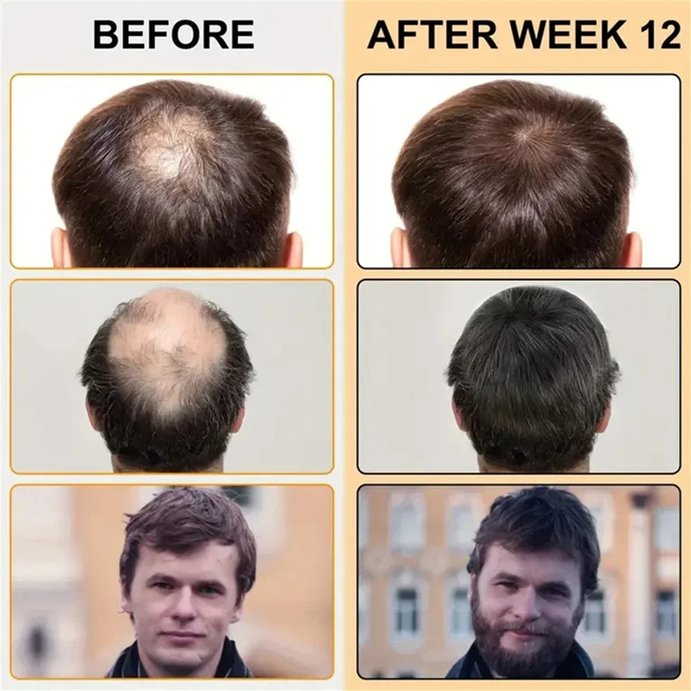 Biotin Hair Growth Oil | Salon-Quality Scalp Treatment - Tidesmit Scrubs Treatments Tidesmit
