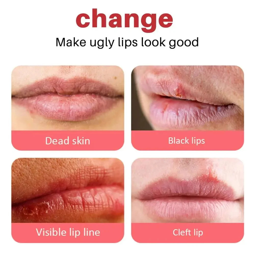 Pink Lip Lightening Cream - Moisturizing Dark Spot Treatment (1-5pc) Lip Care Tidesmit