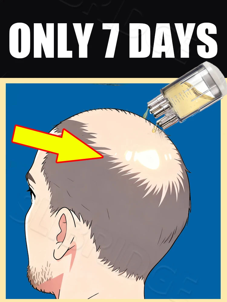 Scalp applicator liquid comb applying hair growth serum to thinning crown for effective hair loss treatment.