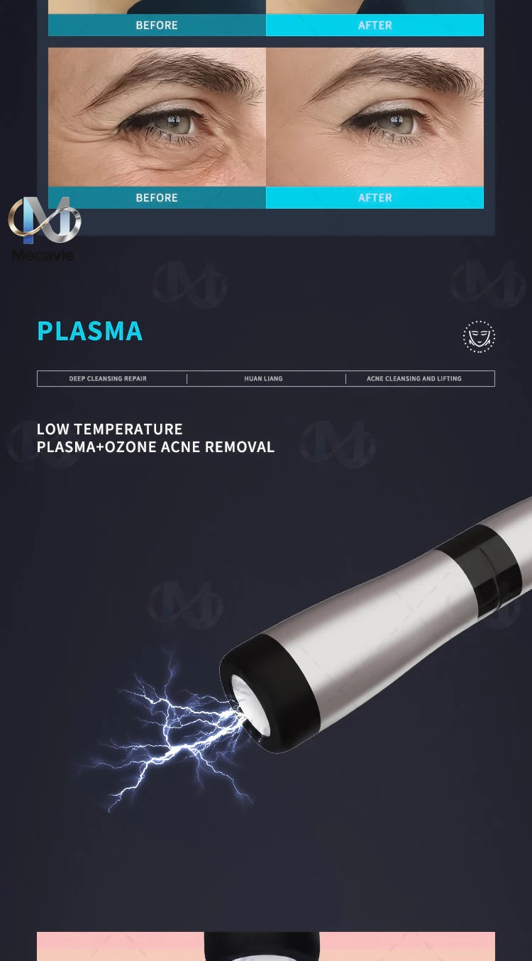 6-in-1 plasma ozone facial machine for deep skin cleaning, acne removal, and wrinkle reduction home beauty care device.
