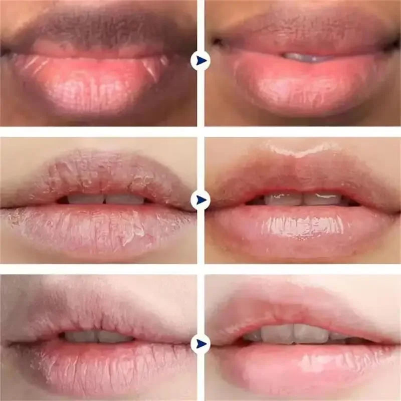 Dark Lip Lightening Balm – Exfoliating Lip Care Treatment by Tidesmit Lip Care Tidesmit