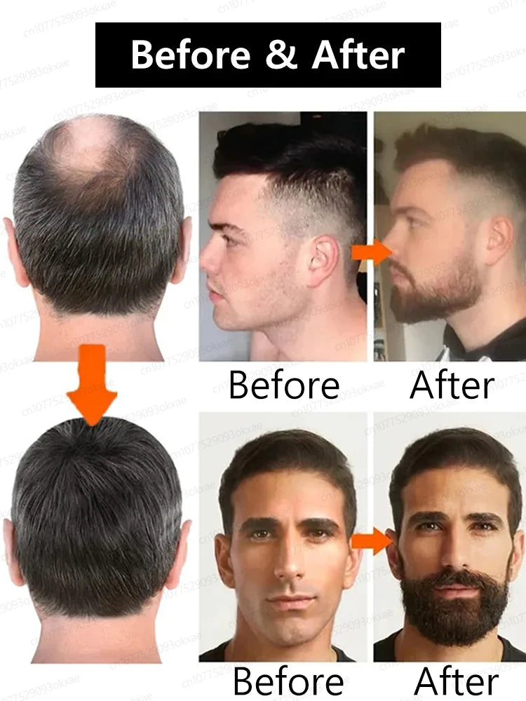 Beard Growth Essence for Thicker Facial Hair - Natural Formula Relaxation Treatment Tidesmit