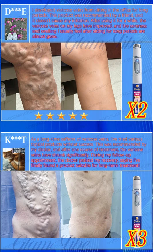 Fascia Gun Deep Tissue Muscle Recovery Massager | Tidesmit Fascia Gun Tidesmit