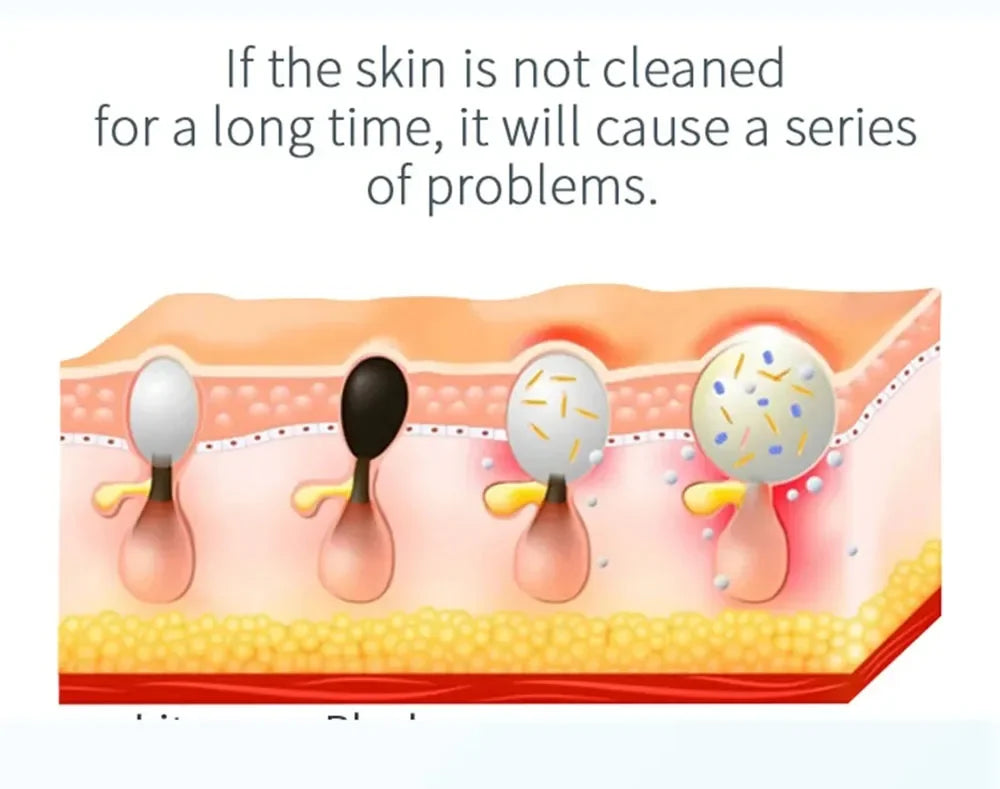 NEW Peeling Beauty Device New Small Bubble Oxygen Injection Instrument Hydra Dermabrasion Aqua Facial Cleaning Suction Blackhead