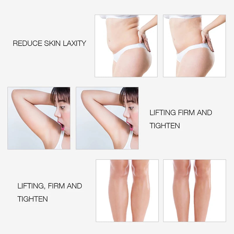 EMS RF Body Slimming Machine - Electric Massager for Muscle Relief Body Shaping Massage Equipment Tidesmit
