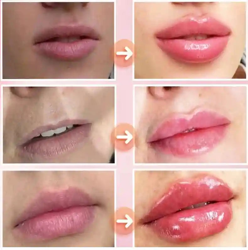 Lip Plumper Serum: Moisturizing Volumizing Treatment for Fuller Lips Lip Care Tidesmit