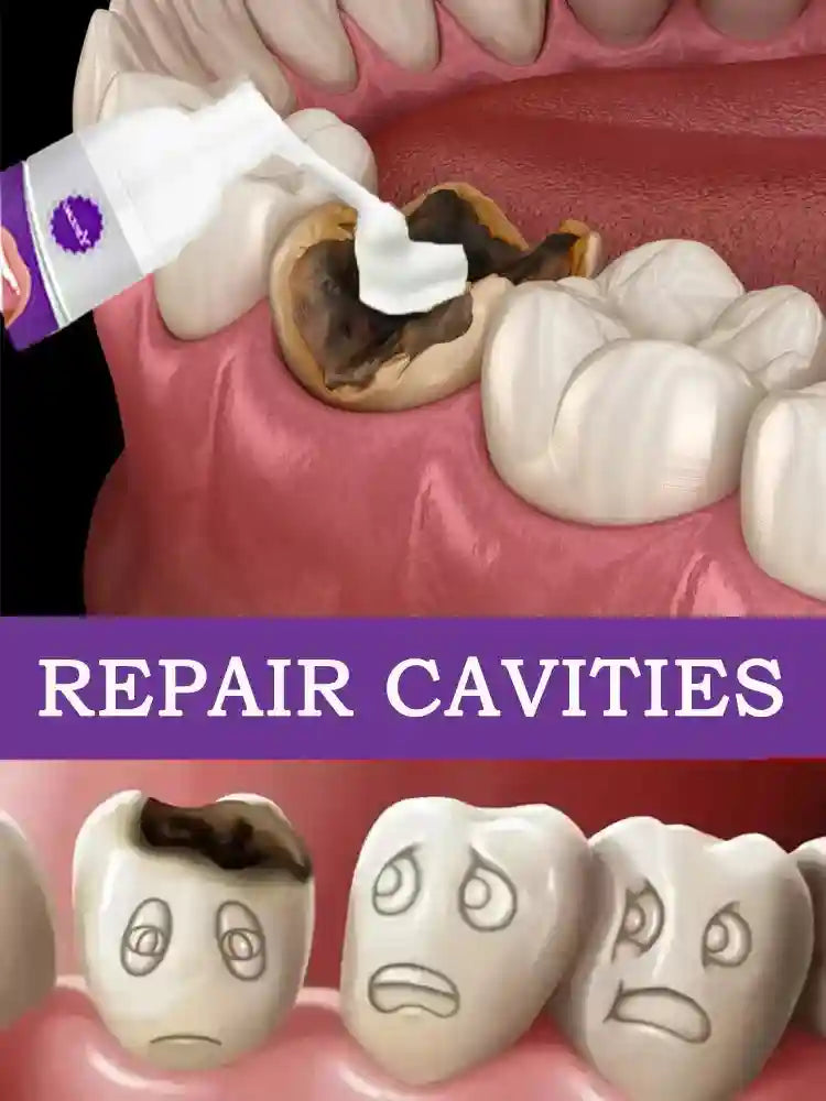 Tidesmit anti-caries teeth whitening gel for cavity repair and tooth decay protection
