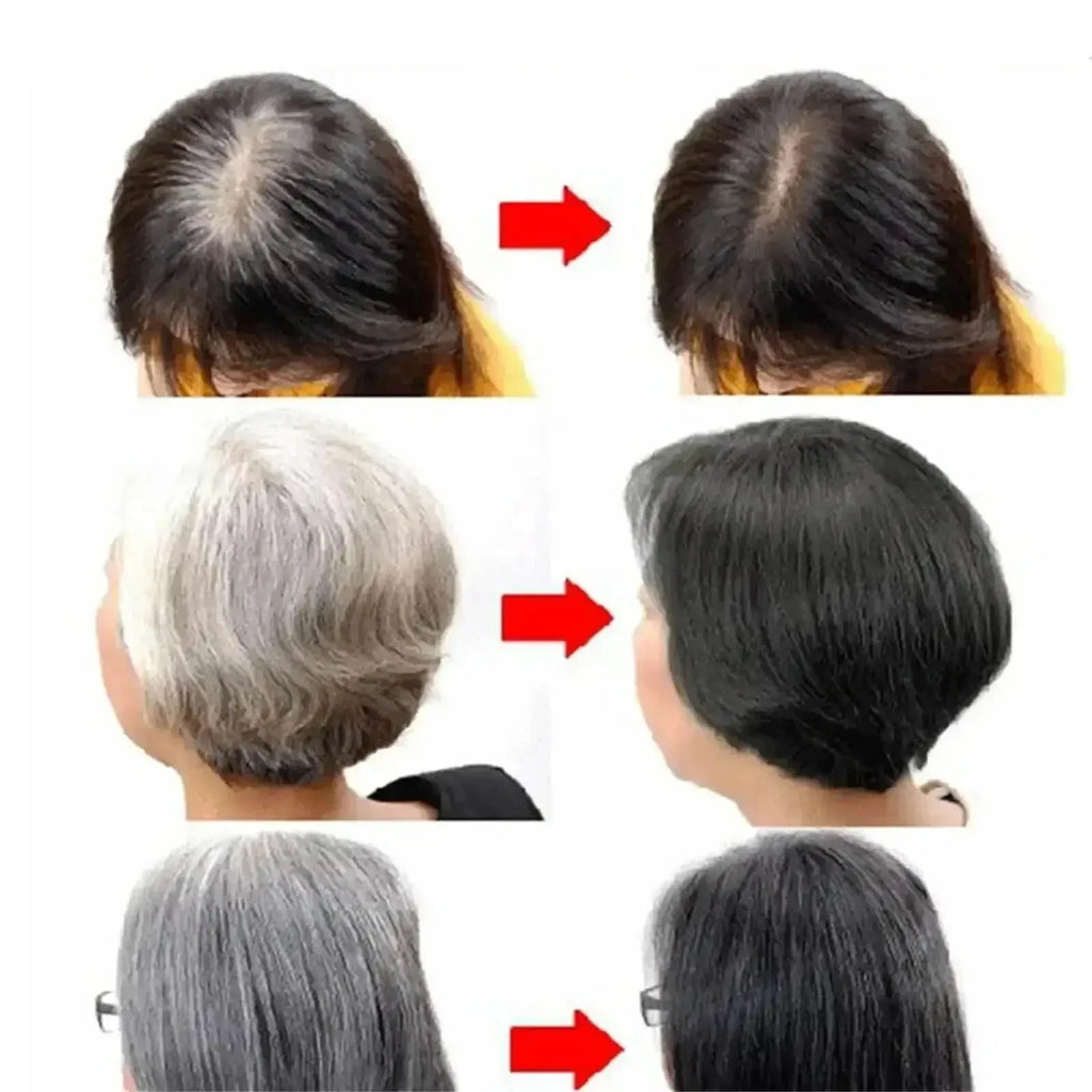 White hair killer, polygonum multiflorum shampoo soap，remove gray hair and restore natural hair color in 7 days