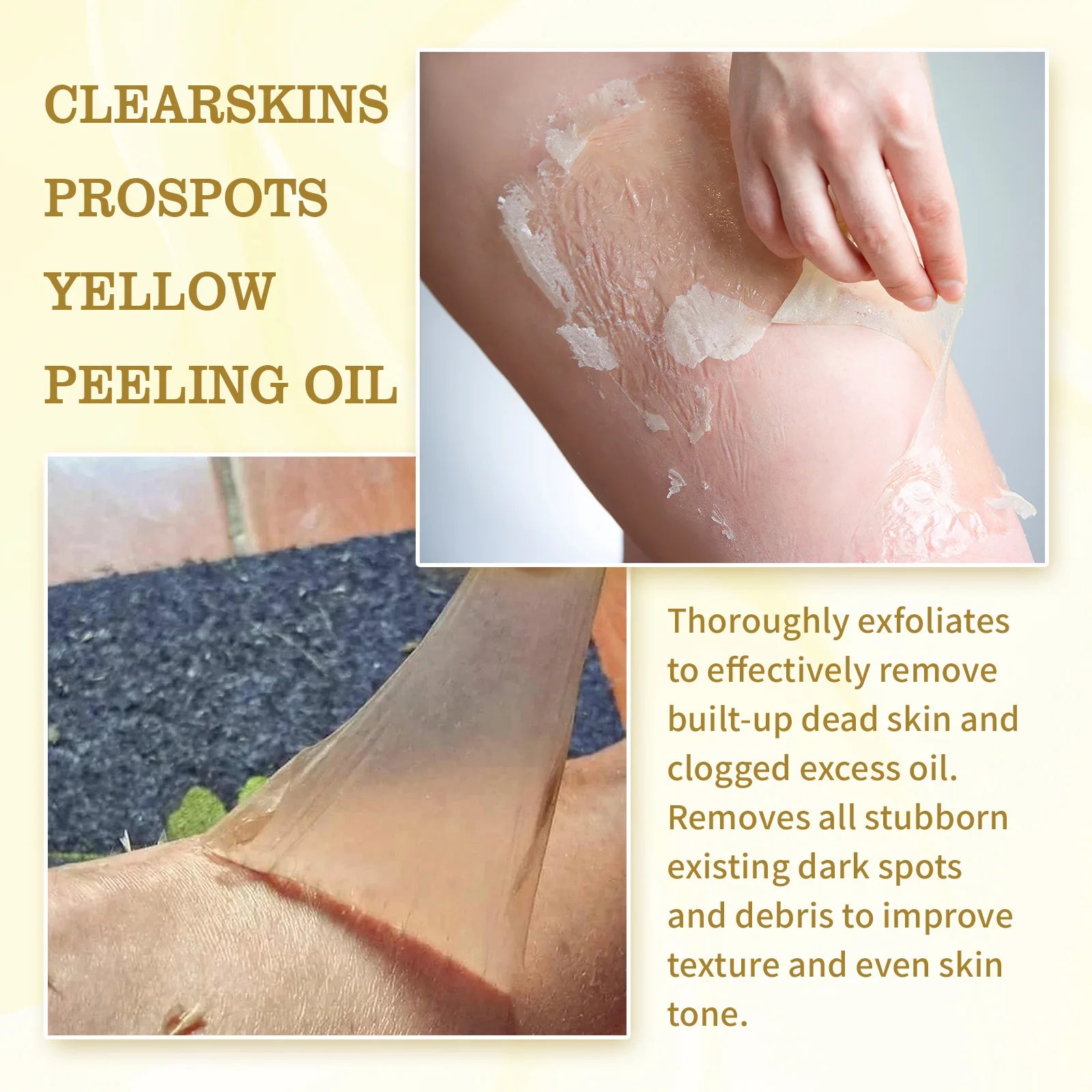 Yellow Peeling Oil for Dark Spots - Exfoliating Serum 50ml-150ml Scrubs Treatments Tidesmit