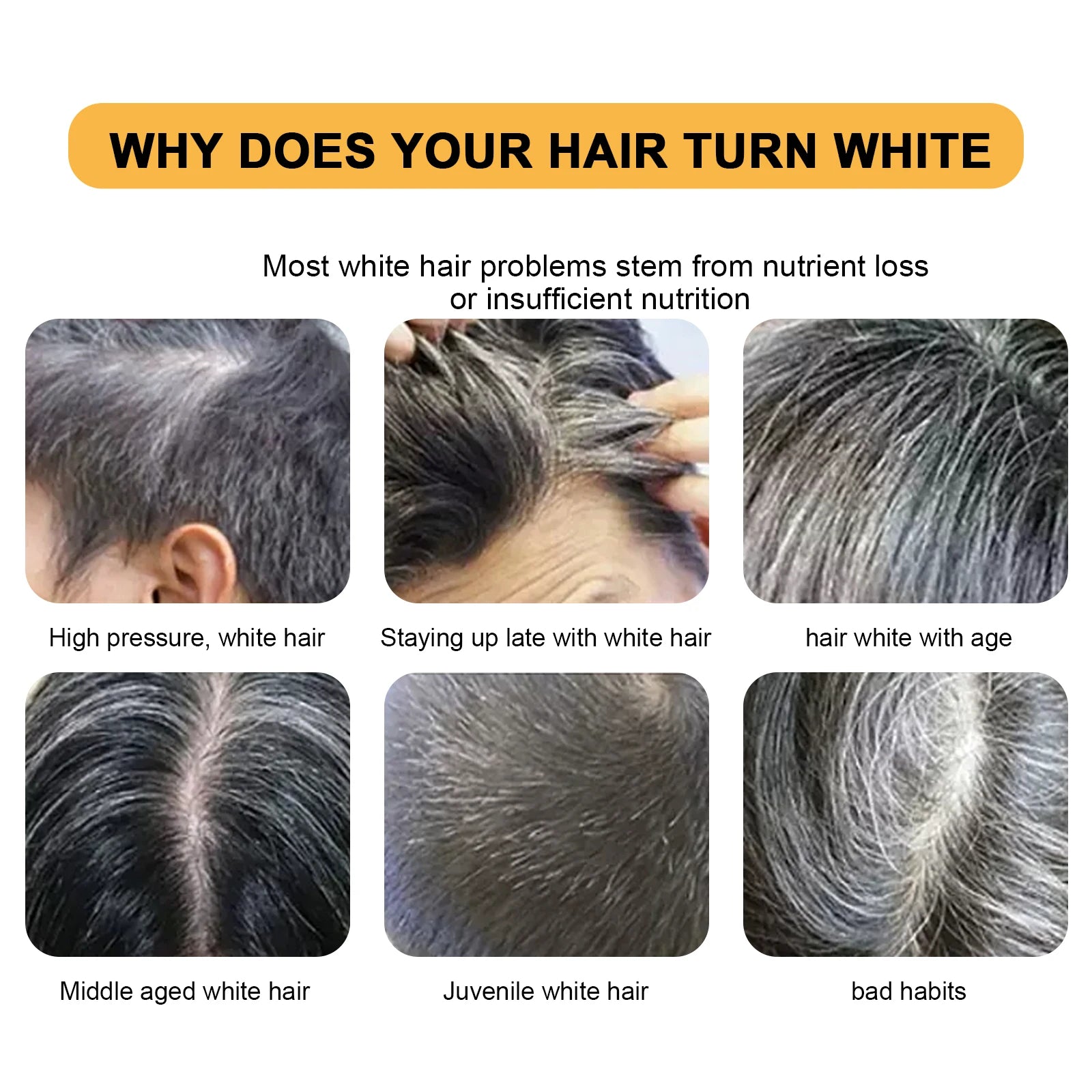 Gray Hair Shampoo Bar Turn Black Improve Dull & White Hair Anti-Dandruff Nourish Scalp  Polygonum Multiflorum Biotin Soap