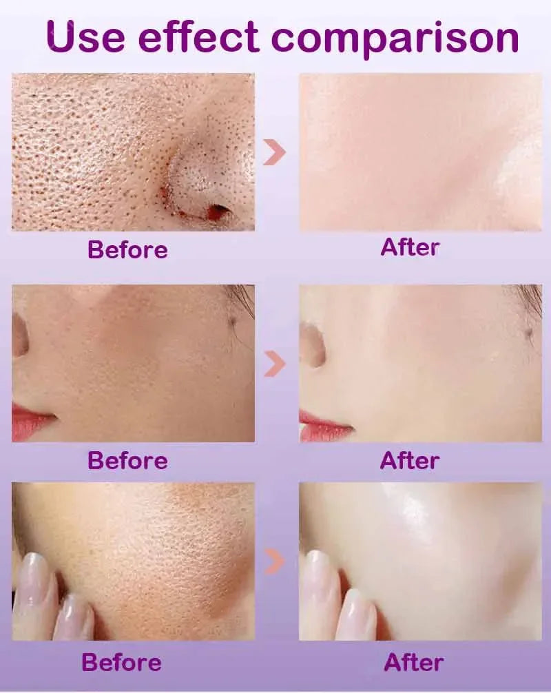 Retinol Niacinamide Serum - Professional PMU Machine Pore Refining Permanent Makeup Machines Tidesmit