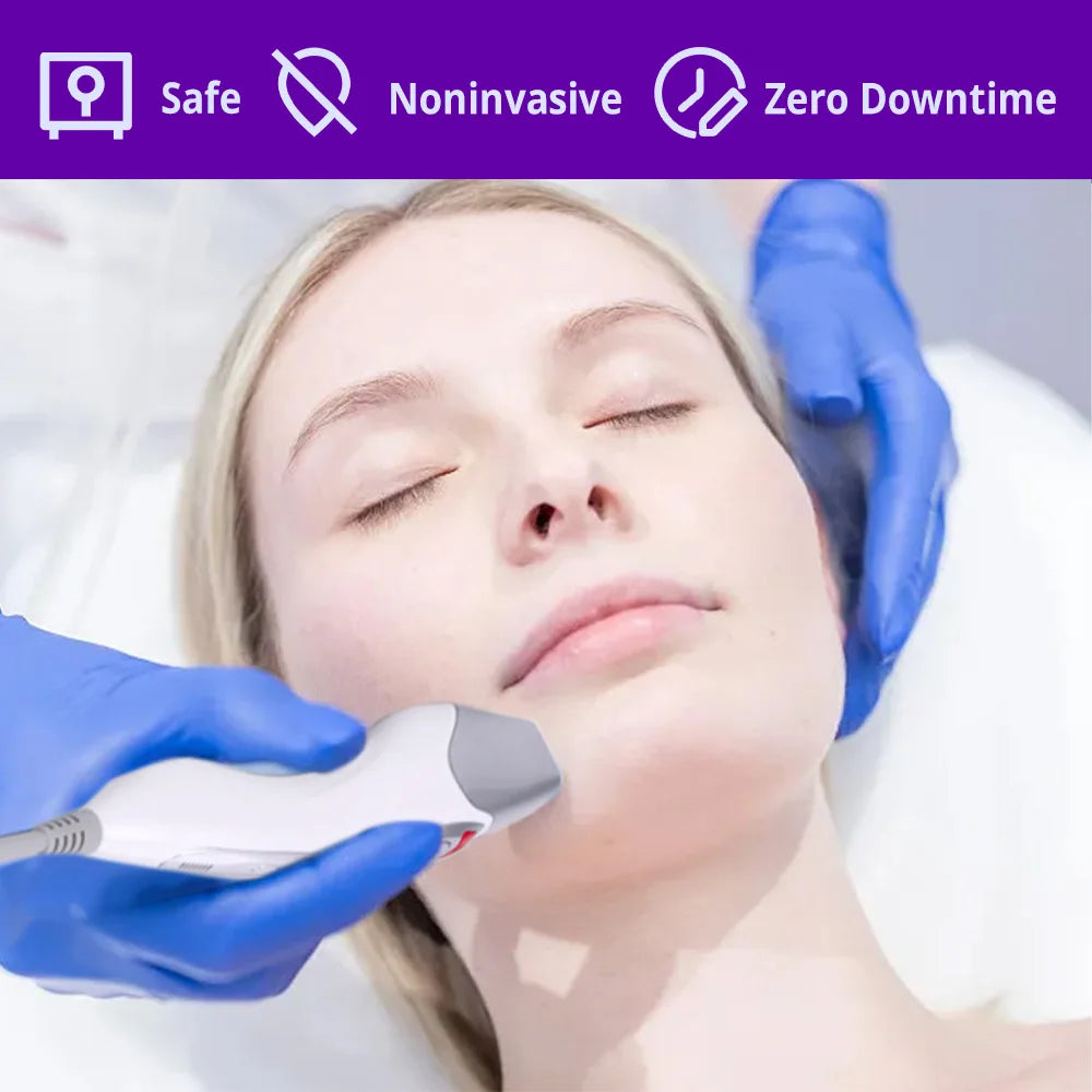 Korean Dot Matrix RF skin lifting device used on face for non-invasive rejuvenation with zero downtime.