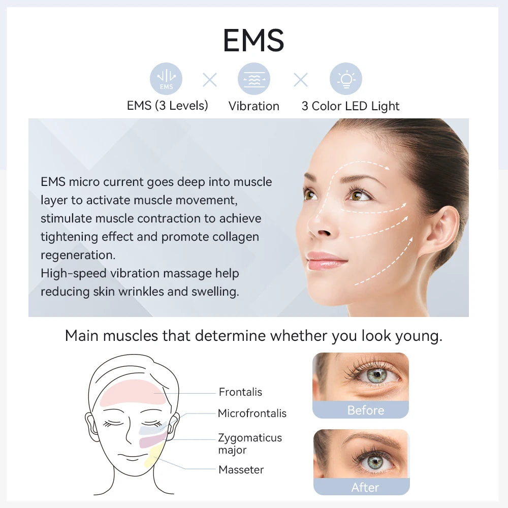 ANLAN EMS facial massager with LED light and vibration for skin lifting, anti-aging, and wrinkle reduction treatment.