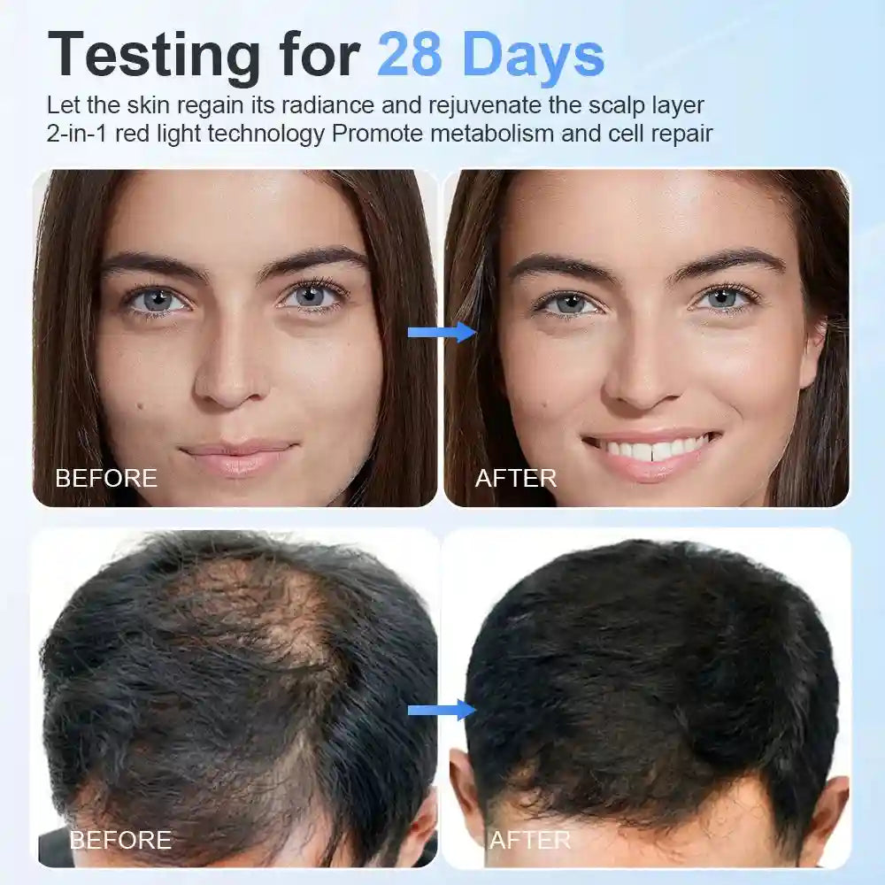 Before and after results of 2-in-1 red light therapy LED mask and cap for skin rejuvenation and hair loss treatment.