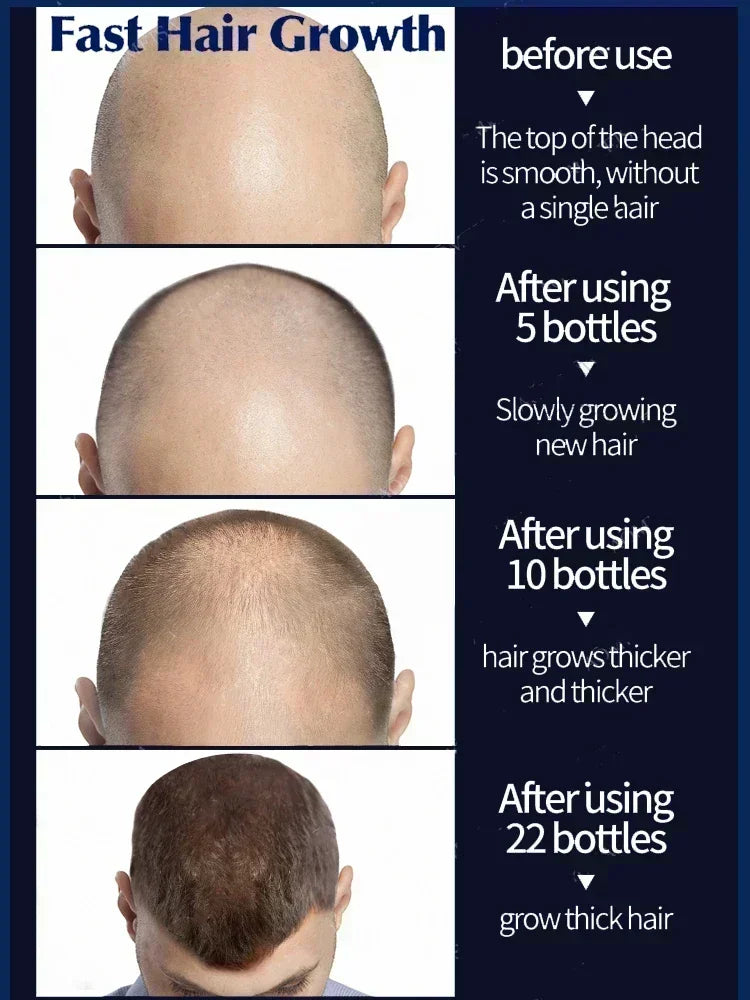 Hair Growth Treatment | Nourishing Scalp Serum for Natural Regrowth Scrubs Treatments Tidesmit
