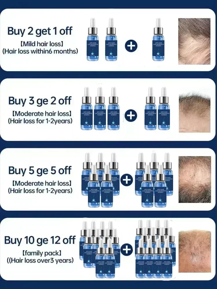Hair Growth Treatment | Nourishing Scalp Serum for Natural Regrowth Scrubs Treatments Tidesmit