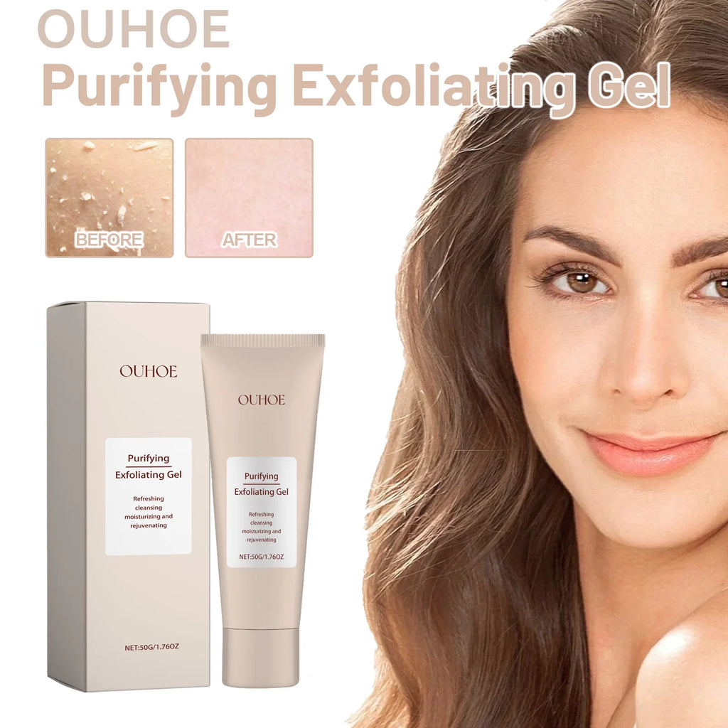 Exfoliating Gel for Pore Cleansing & Acne - 50g Salon-Quality Treatment Scrubs Treatments Tidesmit