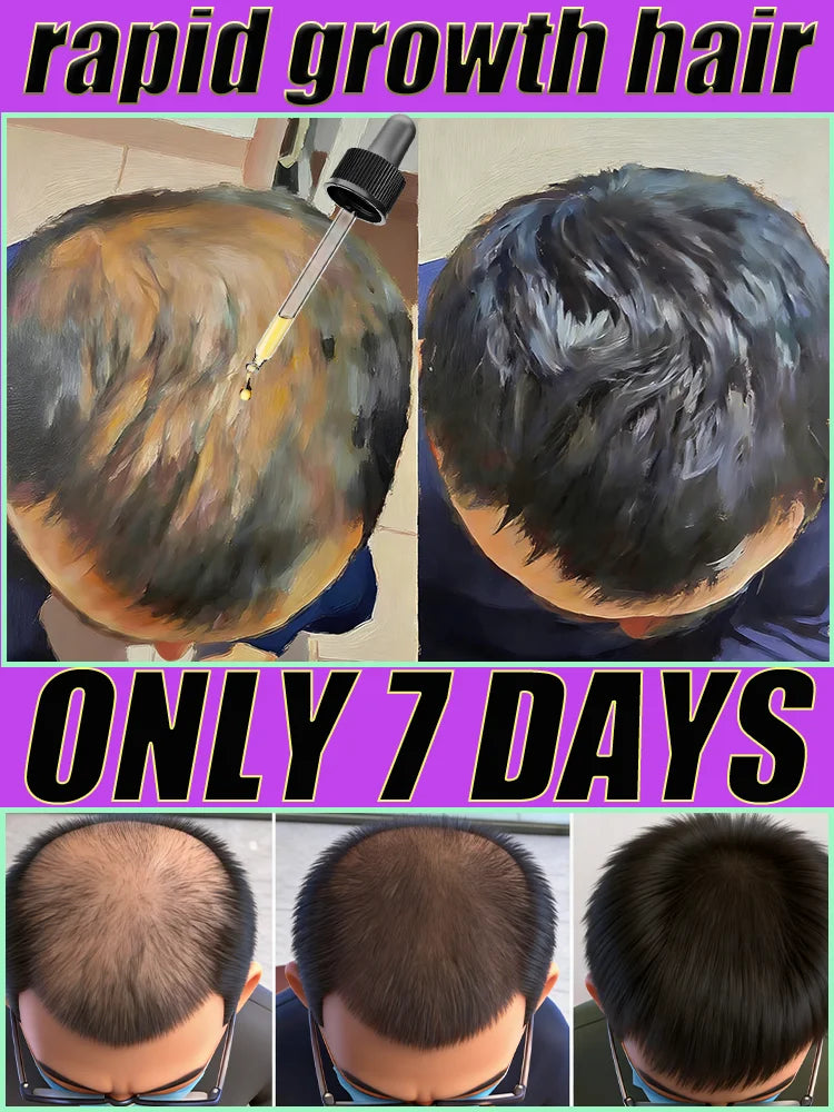 Hair Growth Spray - Nourishing Non-Greasy Formula for Faster Results Relaxation Treatment Buy 5 get 5 Free Tidesmit