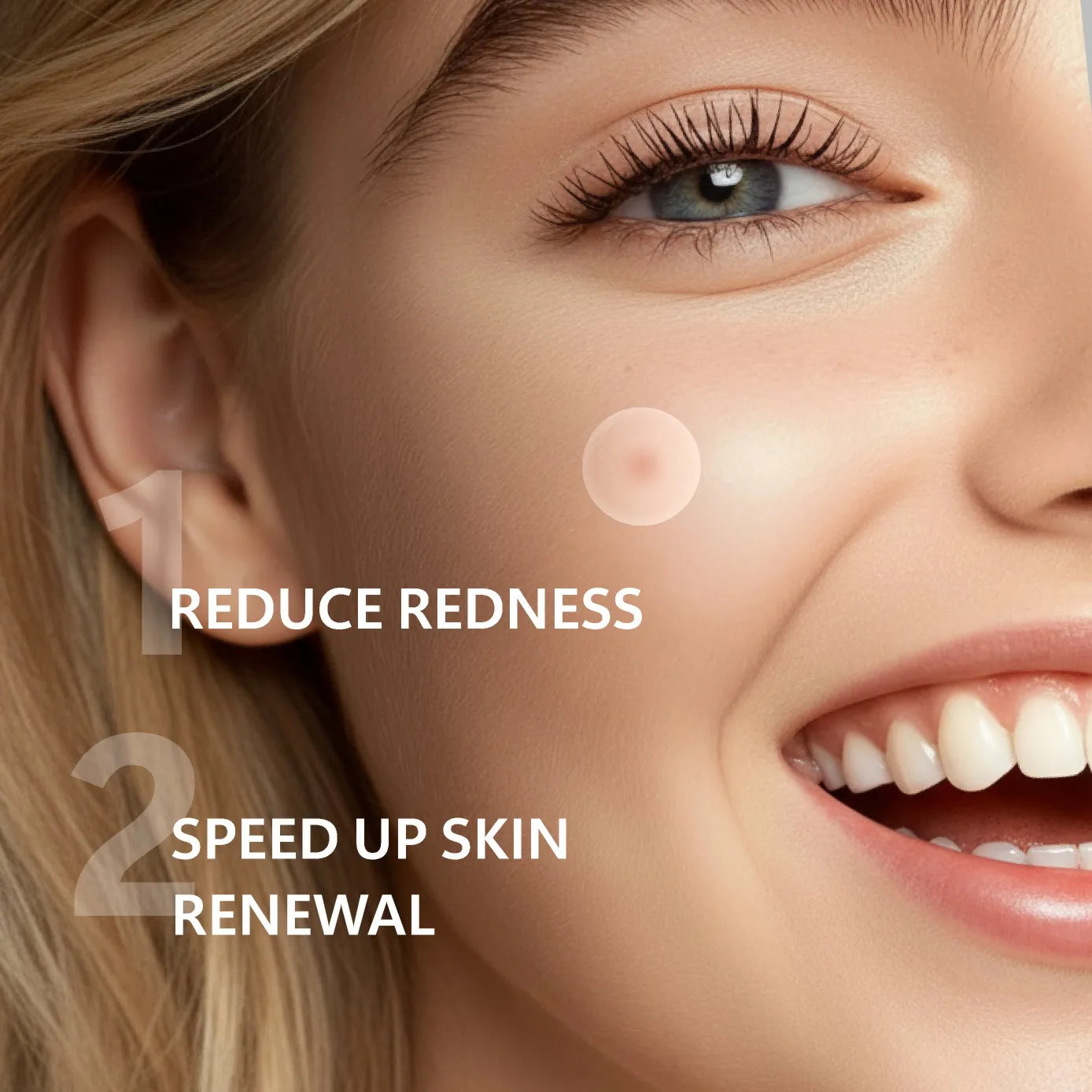 Microneedle acne patch, used to cover blemishes and conceal acne. The microneedles are shorter than 3 millimeters.