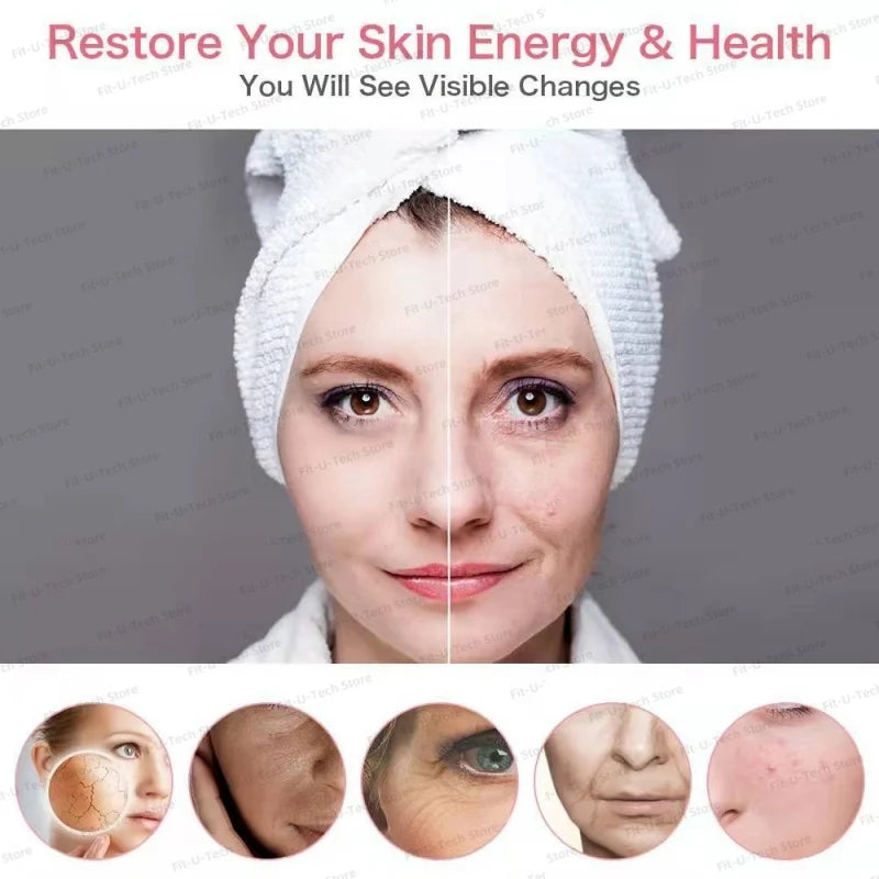 Before-and-after comparison of a woman's face showing improved skin texture and reduction of wrinkles and blemishes.