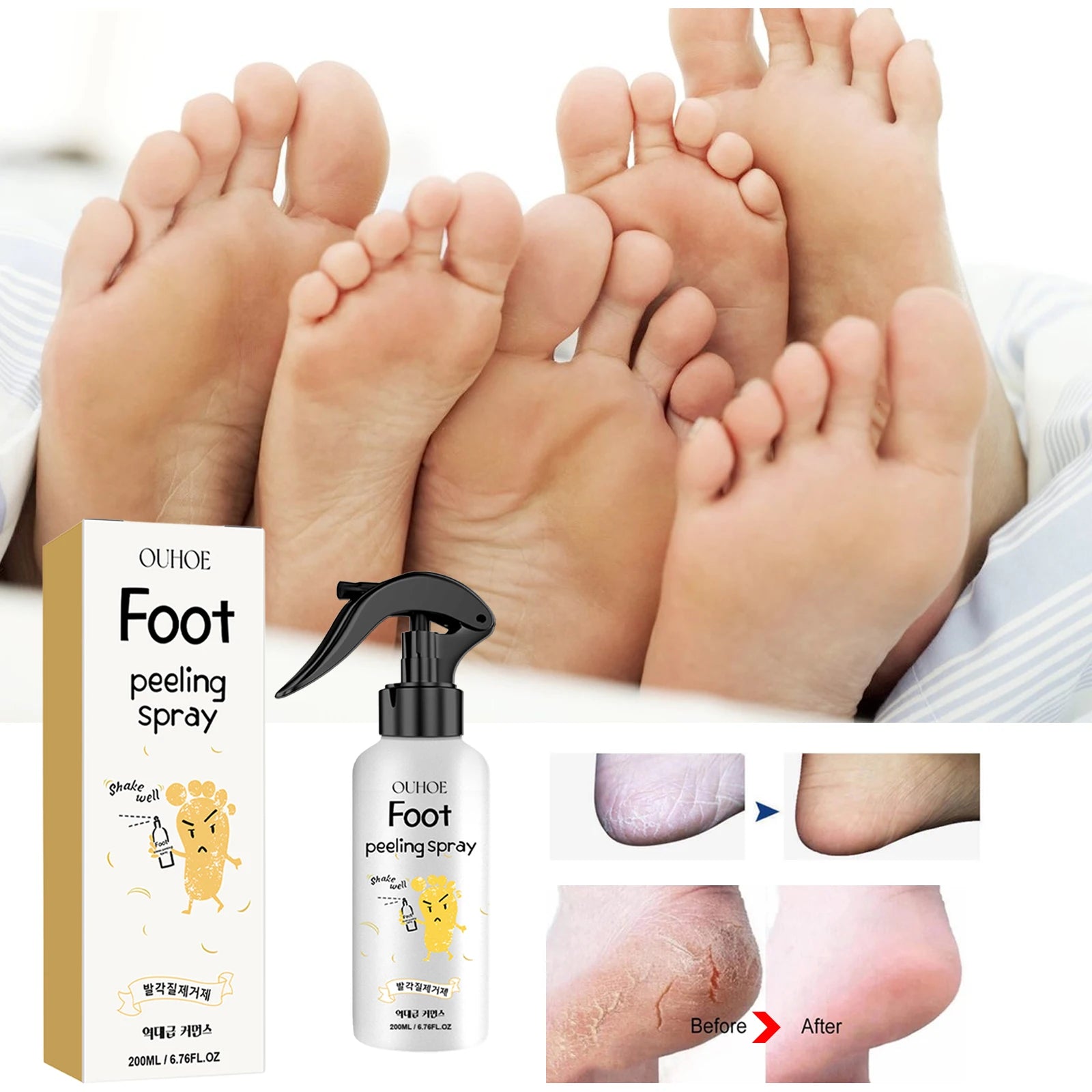 Foot Exfoliating Spray | Professional Callus Remover & Moisture Lock Scrubs Treatments Tidesmit