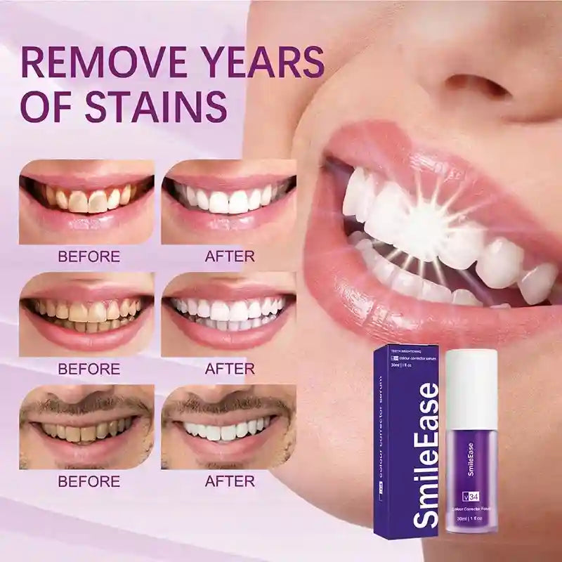 Tidesmit Smilekit purple teeth whitening mousse for tartar removal and fresh breath oral hygiene care