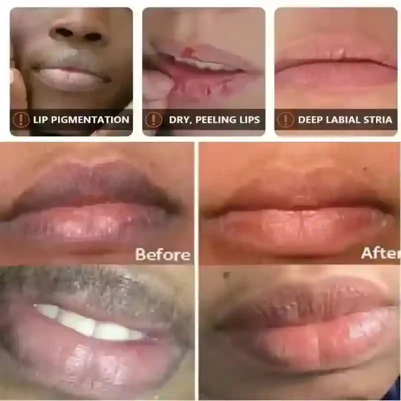 Dark Lip Lightening Mask | Exfoliating Lip Treatment Balm 10g Lip Care Tidesmit