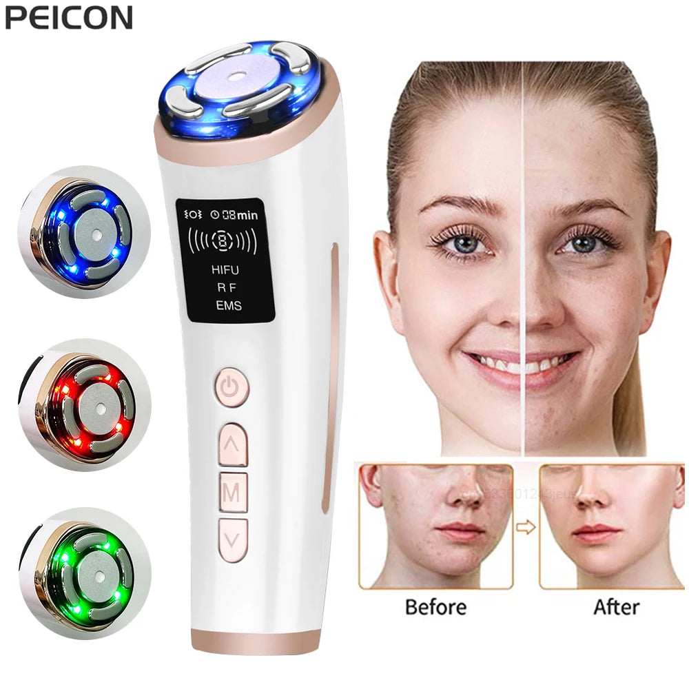 White and rose gold mini HIFU facial massager with LED light settings and a before-and-after skin treatment comparison.