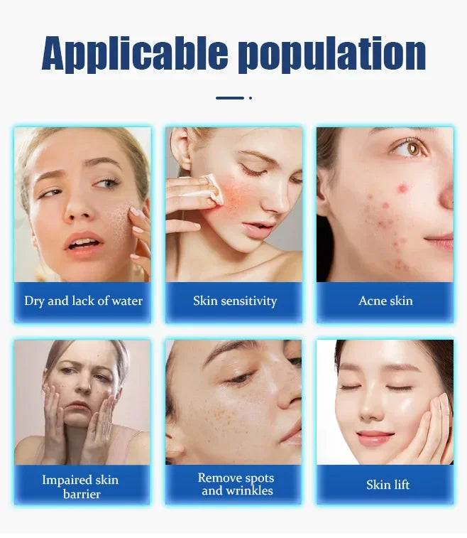 Collage of skin conditions treated by LDM anti-aging face lifting machine for wrinkles, acne, dryness, and firming.