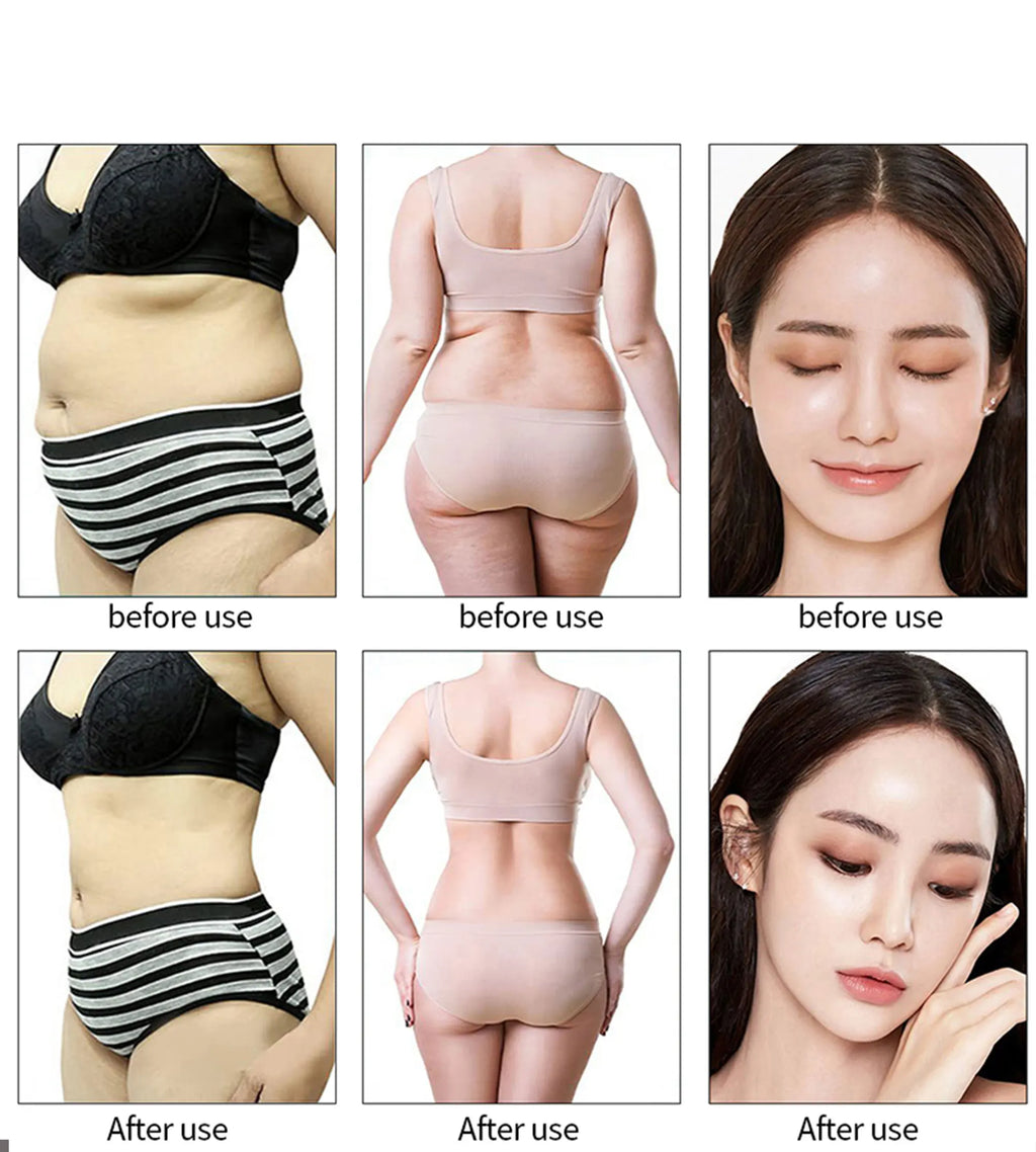 Ultrasonic Cavitation Body Slimmer with RF Skin Tightening - White Relaxation Treatment Tidesmit